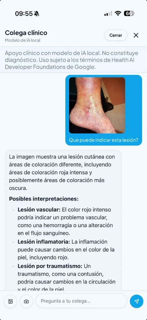 Colega clínico analizando una lesión cutánea con el modelo de IA local